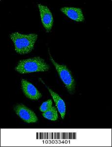 Anti-DAP Kinase 1 Rabbit Polyclonal Antibody (FITC (Fluorescein))