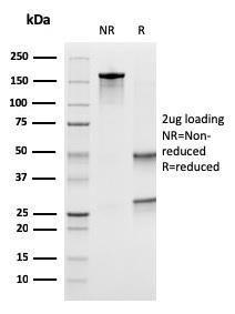 SDS-PAGE analysis of Anti-Uroplakin 1B Antibody [UPK1B/3273] under non-reduced and reduced conditions; showing intact IgG and intact heavy and light chains, respectively. SDS-PAGE analysis confirms the integrity and purity of the antibody.