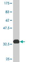 Anti-ATOX1 Mouse Monoclonal Antibody [clone: 3A1]