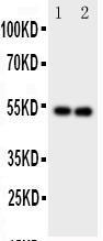 Anti-GABA A Receptor alpha 1 Rabbit Polyclonal Antibody