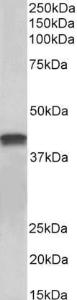 Anti-TNNT2 Antibody (A83132) (0.1µg/ml) staining of Pig Heart lysate (35µg protein in RIPA buffer). Primary incubation was 1 hour. Detected by chemiluminescence.