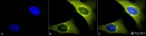 Immunocytochemistry/Immunofluorescence analysis of human heat shocked cervical cancer cell line (HeLa), fixed in 2% formaldehyde for 20 minutes at room temperature, using Anti-Rab4 Antibody (A304983), at 1:150 for 12 hours at 4°