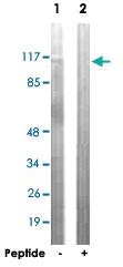 Anti-ATP1A1 Rabbit Polyclonal Antibody