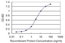 Anti-TPM3 Mouse Monoclonal Antibody [clone: 2E4]