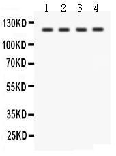 Anti-SLC12A1 Rabbit Polyclonal Antibody