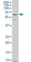 Anti-MEN1 Mouse Polyclonal Antibody