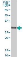 Anti-CLIC1 Mouse monoclonal antibody [clone: 3F9]