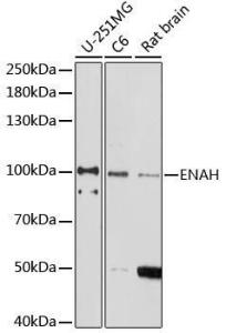 Western blot analysis of extracts of various cell lines, using Anti-ENAH / MENA Antibody (A92800) at 1:1,000 dilution. The secondary antibody was Goat Anti-Rabbit IgG H&L Antibody (HRP) at 1:10,000 dilution.