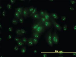 Anti-PSMC6 Mouse Monoclonal Antibody [clone: 2C4]