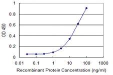 Anti-TNIK Mouse Monoclonal Antibody [clone: 3D4]