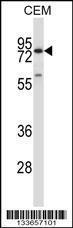 Anti-MMP16 Rabbit Polyclonal Antibody (HRP (Horseradish Peroxidase))