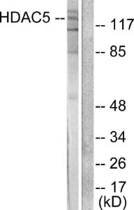 Western blot analysis of lysates from HepG2 cells, treated with PMA 125ng/ml 30' using Anti-HDAC5 Antibody. The right hand lane represents a negative control, where the antibody is blocked by the immunising peptide