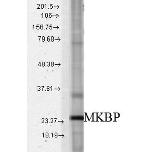 Western blot analysis of rat tissue mix showing detection of HSPB2 protein using Anti-Hsp27 Antibody (A304984) at 1:1,000 for 2 hours at room temperatur