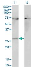 Anti-HOXB7 Mouse Monoclonal Antibody [clone: 3F3]