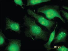 Anti-EIF2S3 Mouse Monoclonal Antibody [clone: 2C9]