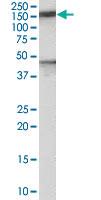 Anti-PTCH1 Goat Polyclonal Antibody