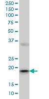 Anti-RBBP9 Mouse Monoclonal Antibody [clone: 2A11]