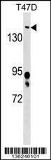 Anti-BRD4 Rabbit Polyclonal Antibody (AP (Alkaline Phosphatase))