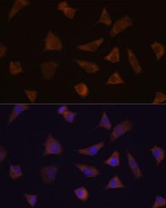 Immunofluorescence analysis of L929 cells using Anti-ENAH / MENA Antibody (A92800) at a dilution of 1:100. DAPI was used to stain the cell nuclei (blue).