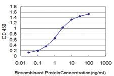 Anti-HOXB7 Mouse Monoclonal Antibody [clone: 3F3]