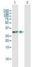 Anti-GORAB Mouse Polyclonal Antibody