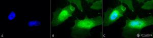 Immunocytochemistry/Immunofluorescence analysis of human heat shocked cervical cancer cell line (HeLa), fixed in 2% formaldehyde for 20 minutes at room temperature, using Anti-Hsp27 Antibody (A304984), at 1:100 for 12 hours at 4°