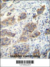 Anti-CDH24 Rabbit Polyclonal Antibody