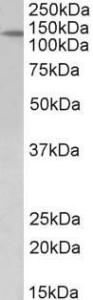 Anti-PTCH1 Antibody (A83134) (2 µg/ml) staining of Mouse fetal Kidney lysate (35 µg protein in RIPA buffer).Detected by chemilu minescence