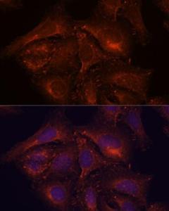 Immunofluorescence analysis of U-2 OS cells using Anti-ENAH / MENA Antibody (A92800) at a dilution of 1:100. DAPI was used to stain the cell nuclei (blue).