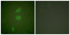 Immunofluorescence analysis of NIH/3T3 cells using Anti-HDAC5 Antibody. The right hand panel represents a negative control, where the antibody was pre-incubated with the immunising peptide