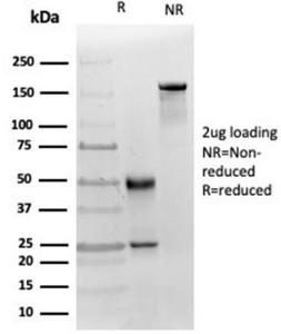 SDS-PAGE analysis of Anti-MICA Antibody [MICA/4442] under non-reduced and reduced conditions; showing intact IgG and intact heavy and light chains, respectively. SDS-PAGE analysis confirms the integrity and purity of the Antibody