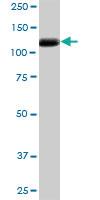 Anti-EPHA2 Mouse Polyclonal Antibody