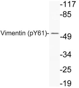 Antibody anti-vimentin phospho TYR61