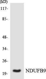 Western blot analysis of the lysates from COLO205 cells using Anti-NDUFB9 Antibody