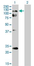 Anti-EPHA2 Mouse Polyclonal Antibody