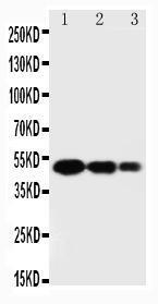 Anti-SPARC Rabbit Polyclonal Antibody