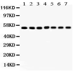 Anti-SMAD1/2/3/4/5 Rabbit Polyclonal Antibody