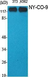 Western blot analysis of various cells using Anti-HDAC5 Antibody