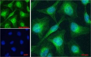 Anti-PTCH1 Antibody (A83134) Immunofluorescence analysis of paraformaldehyde fixed HeLa cells, permeabilized with 0.15% Triton. Primary incubation 1 hr (5 µg/ml) followed by Alexa Fluor 488 secondary Antibody (1 µg/ml), showing cytoplasmic and Golgi apparatus staining