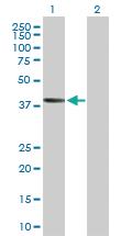 Anti-AADACL2 Mouse Polyclonal Antibody