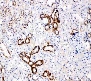 Anti-GLUT5 Rabbit Polyclonal Antibody