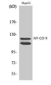 Western blot analysis of HepG2 cells using Anti-HDAC5 Antibody