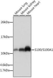 Western blot analysis of extracts of various cell lines, using Anti-S100 alpha Antibody [ARC0404] (A306114) at 1:1000 dilution. The secondary Antibody was Goat Anti-Rabbit IgG H&L Antibody (HRP) at 1:10000 dilution. Lysates/proteins were present at 25 µg per lane