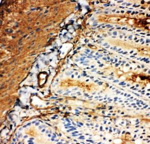 Anti-GLUT5 Rabbit Polyclonal Antibody