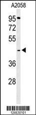 Anti-TECR Rabbit Polyclonal Antibody (HRP (Horseradish Peroxidase))