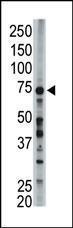 Anti-ACSL6 Rabbit Polyclonal Antibody (HRP (Horseradish Peroxidase))