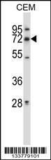 Anti-MMP19 Rabbit Polyclonal Antibody (APC (Allophycocyanin))