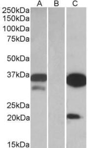 HEK293 lysate (10ug protein in RIPA buffer) over expressing Human DAPP1 with DYKDDDDK tag probed with Anti-DAPP1 Antibody (A84728) (0