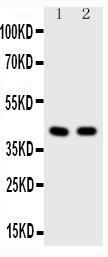 Anti-HDAC8 Rabbit Polyclonal Antibody