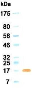 Western blotting result